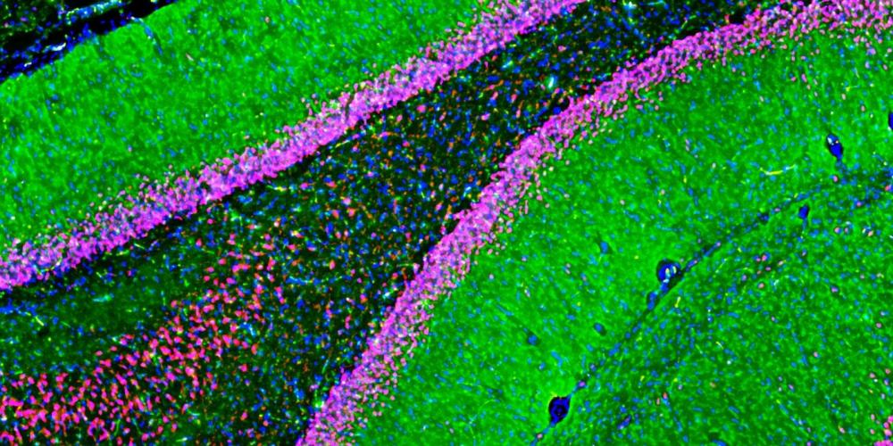Fluorescent image showing AMPA receptor expression in rat dentate gyrus and CA1 using Hello Bio GluA1-4 Antibody (HB7534)