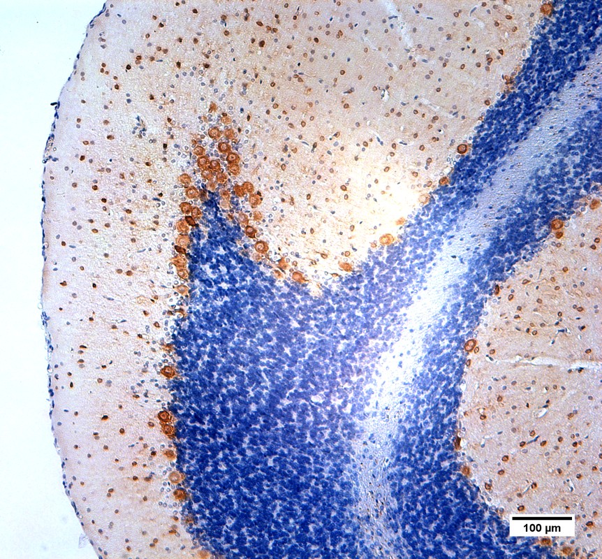 Figure 2. Parvalbumin positive neurons visualized in rat cerebellum using DAB staining using hematoxylin counterstain