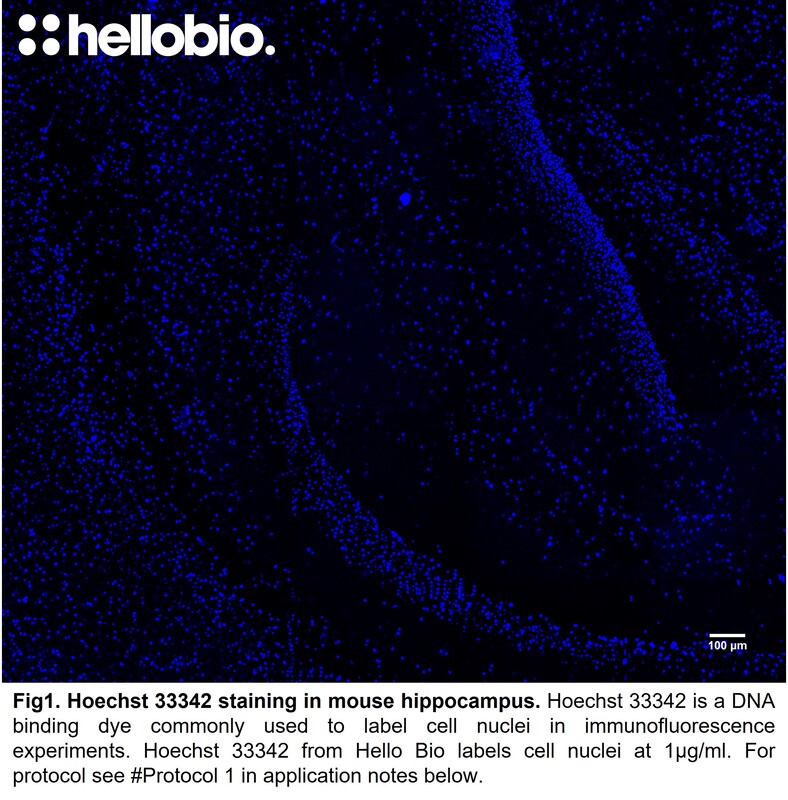 Hoechst 33342 staining in mouse hippocampus