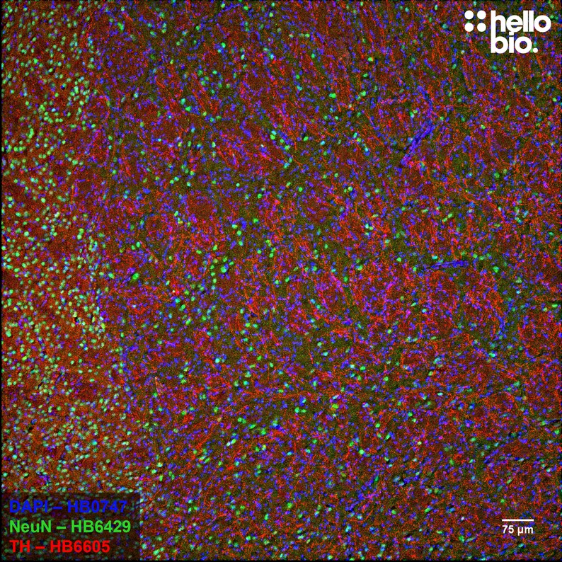 Figure 2. NeuN and Tyrosine hydroxylase expression in rat striatum. 