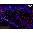 Figure 1. Parvalbumin and Calretinin expressing interneurons in the rat hippocampus.
