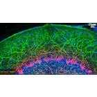 Figure 1. βIII-tubulin and Neurofilament light staining in rat cerebellum. Mounted using MightyMount<sup>TM</sup> Antifade Fluorescence Mounting Medium (aqueous).