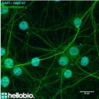 Fig 1: Neurofilament L and DAPI co-staining in hippocampal cell culture.