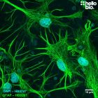 Figure 1. GFAP expression in a rat cultured neurone preparation visualised using HB8267.