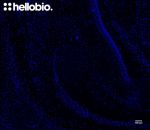 Hoechst 33342 staining in mouse hippocampus