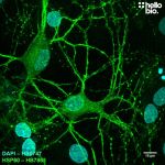 Figure 1. HSP60 staining with HB7863 reveals the dense mitochondria in cultured rat neurones.
