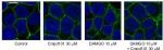 Inhibition of DAMGO-induced MOPr internalization by Cmpd101