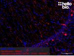 Figure 1: Tyramide signal amplification of parvalbumin positive interneurons in the rat hippocampus.