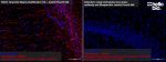 Figure 1: Tyramide Signal Amplification  compared to detection using secondary biotin antibody and streptavidin