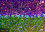 Figure 1. Calbindin and GFAP staining in the cerebellum. Mounted using MightyMount<sup>TM</sup> Antifade Fluorescence Mounting Medium with DAPI (hardset)