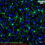 Figure 5. IBA1 staining in the hippocampal region of rat brain using HB7847 and HB9317 Goat Anti-Rabbit H&L (AF488)