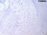 Figure 1. Hematoxylin staining in mouse striatum