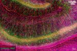 Figure 1. Parvalbumin and Neurofilament L staining in rat hippocampus. Mounted using MightyMount<sup>TM</sup> Antifade Fluorescence Mounting Medium with Propidium Iodide (aqueous).