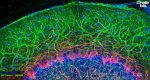 Figure 1. βIII-tubulin and Neurofilament light staining in rat cerebellum. Mounted using MightyMount<sup>TM</sup> Antifade Fluorescence Mounting Medium (aqueous).