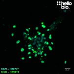 Figure 3. Mixed proliferating and non-proliferating cells in mixed neuronal cultures visualised using HB9919.