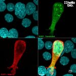 Figure 1. pEGFP-C2 transfected HEK293 cells showing co-localised staining of EGFP and HB8912.