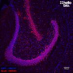 Figure 1. NeuN expressing neurons in the dentate gyrus visualised using HB9493.