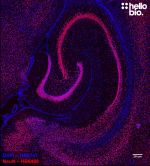 Figure 2. NeuN expressing neurons in the rat hippocampus visualised using HB6498