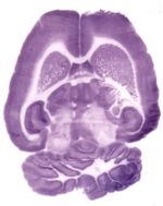 NBT/BCIP Stock Solution