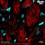Figure 1. Neurofilament L staining in rat brain using HB8556 Goat Anti-Rabbit IgG H&L (Janelia Fluor® 549) preadsorbed secondary antibody.