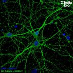 Figure 1. βIII tubulin staining with HB8947 of cultured rat hippocampal neurons.