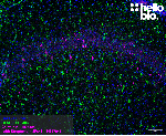 Figure 1. Calretinin positive interneurons and astrocytes in the rat hippocampus.