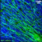 MBP staining in the rat cerebellum