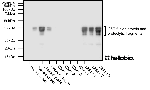 Figure 1. Expression and purification of a GST-fusion protein monitored using HB9897.