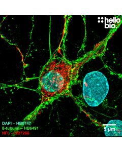 Figure 1. ß-Tubulin and Neurofilament L expression in cultured rat neurones