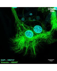 Figure 3. Vimentin expression in glia within a cultured rat neuron preparation.