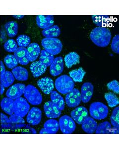 Figure 1. Ki-67 expression in proliferating HEK293T cells