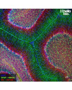 Figure 1. GFAP and Neurofilament L staining in rat cerebellum. Mounted using MightyMount<sup>TM</sup> Antifade Fluorescence Mounting Medium with DAPI (aqueous).