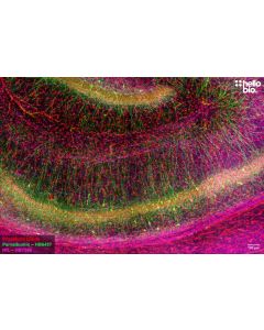 Figure 1. Parvalbumin and Neurofilament L staining in rat hippocampus. Mounted using MightyMount<sup>TM</sup> Antifade Fluorescence Mounting Medium with Propidium Iodide (aqueous).