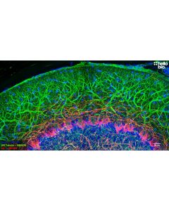 Figure 1. βIII-tubulin and Neurofilament light staining in rat cerebellum. Mounted using MightyMount<sup>TM</sup> Antifade Fluorescence Mounting Medium (aqueous).