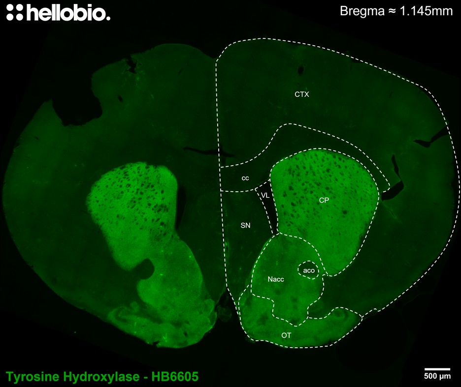 Figure 1. Tyrosine hydroxylase staining in mouse striatum and nucleus accumbens using HB6605. 