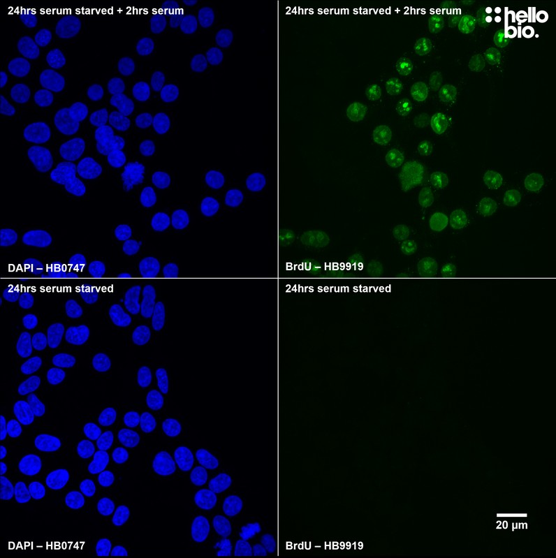 Figure 1. BrdU Immunoreactivity in HEK293T cells either serum starved or starved then stimulated with 20% serum.