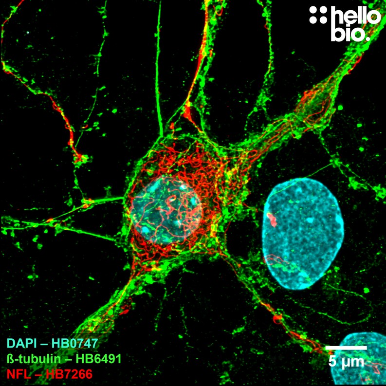 Figure 1. ß-Tubulin and Neurofilament L expression in cultured rat neurones