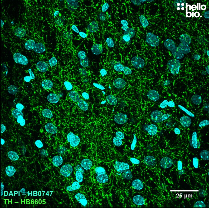 Figure 5. Tyrosine hydroxylase staining in rat striatum using HB6605.