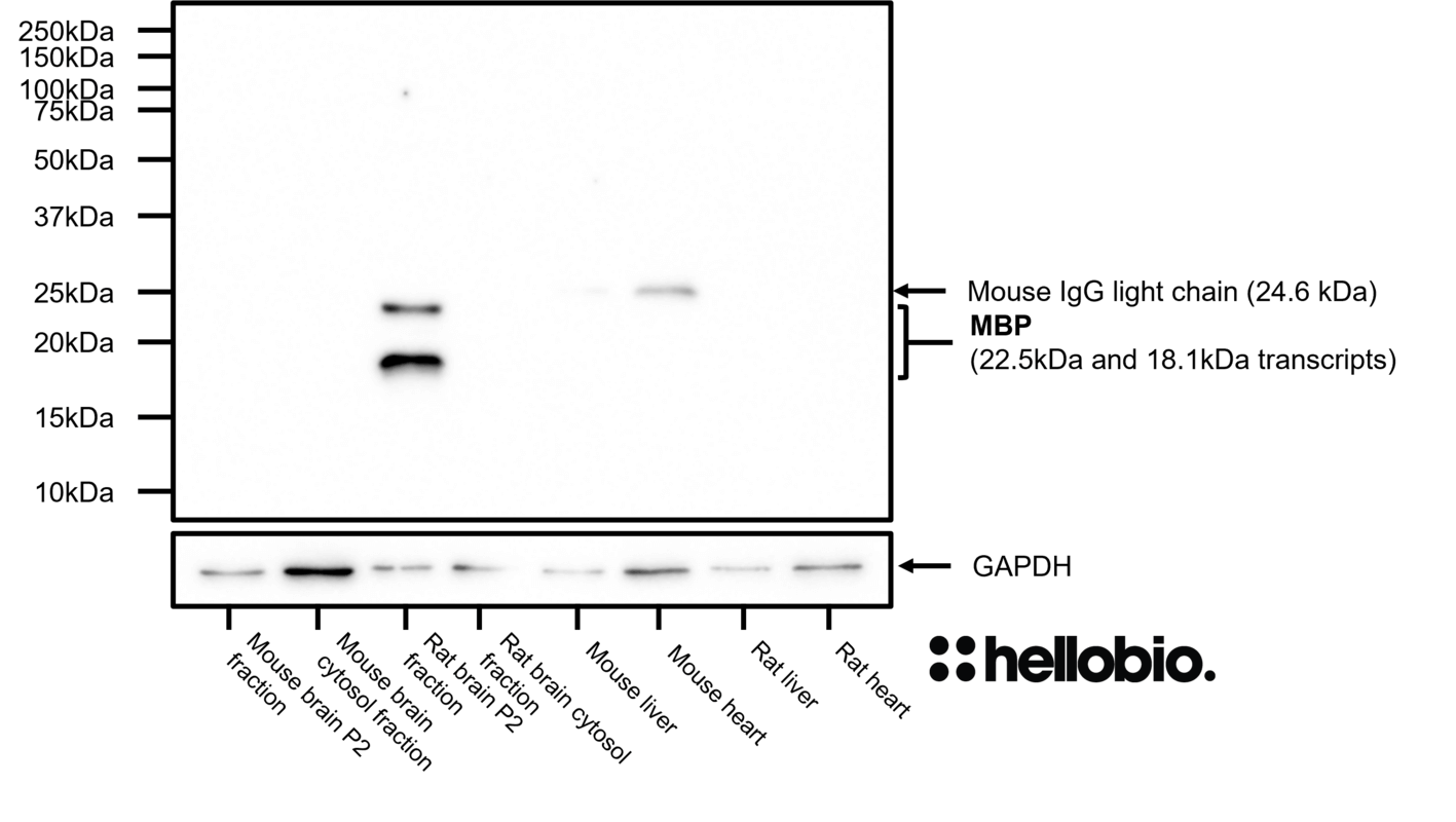 Figure 3. MBP expression in various tissue lysates and preparations.