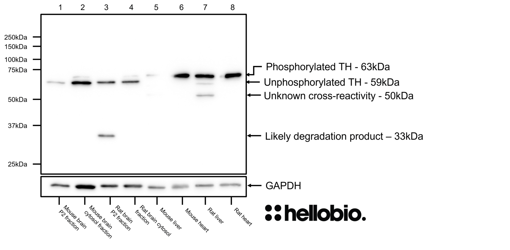 Figure 6. Tyrosine hydroxylase expression in various tissue lysates and preparations.