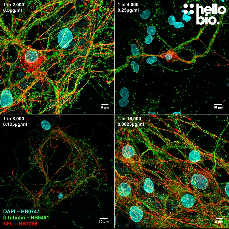 Figure 5. The effect of varying HB6491 concentration upon ß-tubulin staining in cultured rat neurones. 