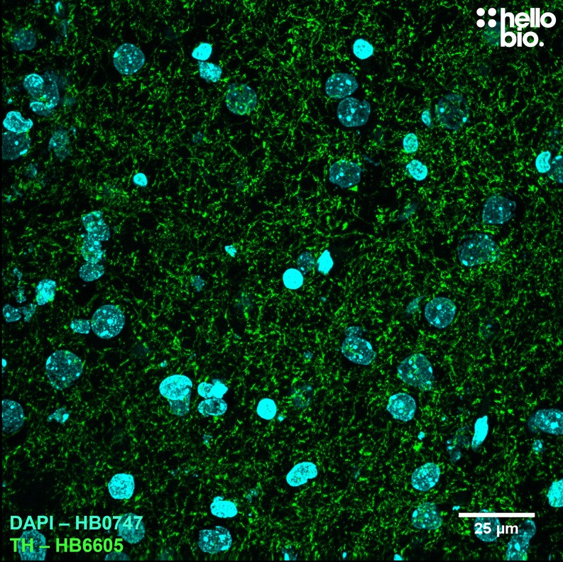 Figure 9. Tyrosine hydroxylase staining in rat striatum using HB6605. 