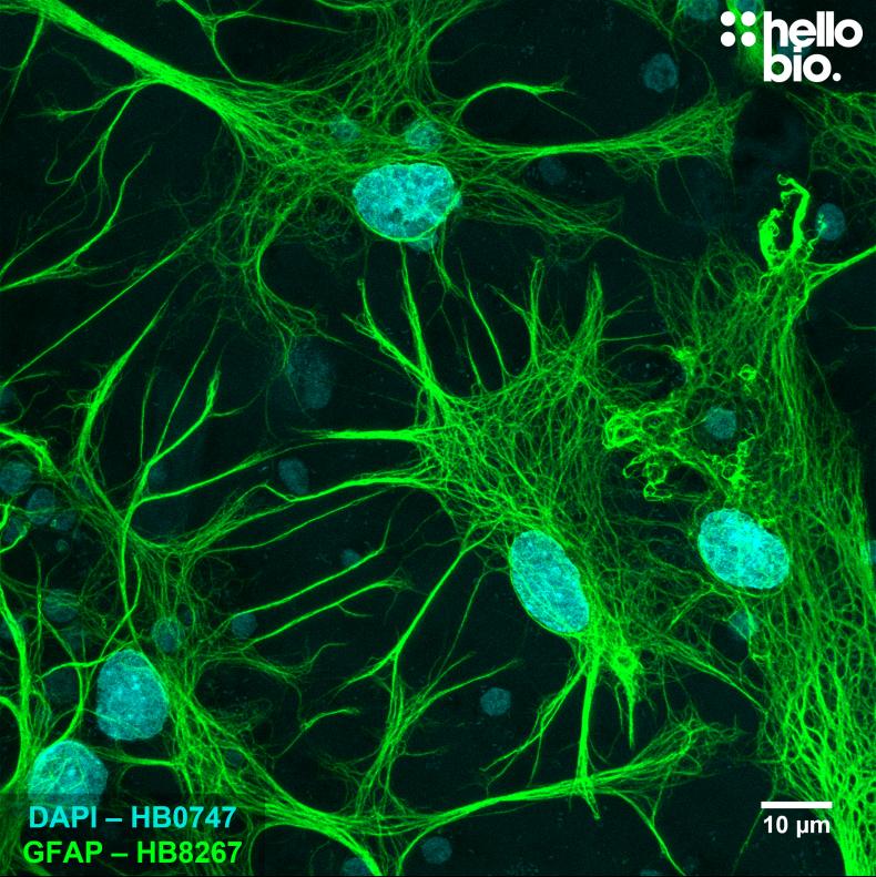 Figure 1. GFAP expression in a rat cultured neurone preparation visualised using HB8267. 