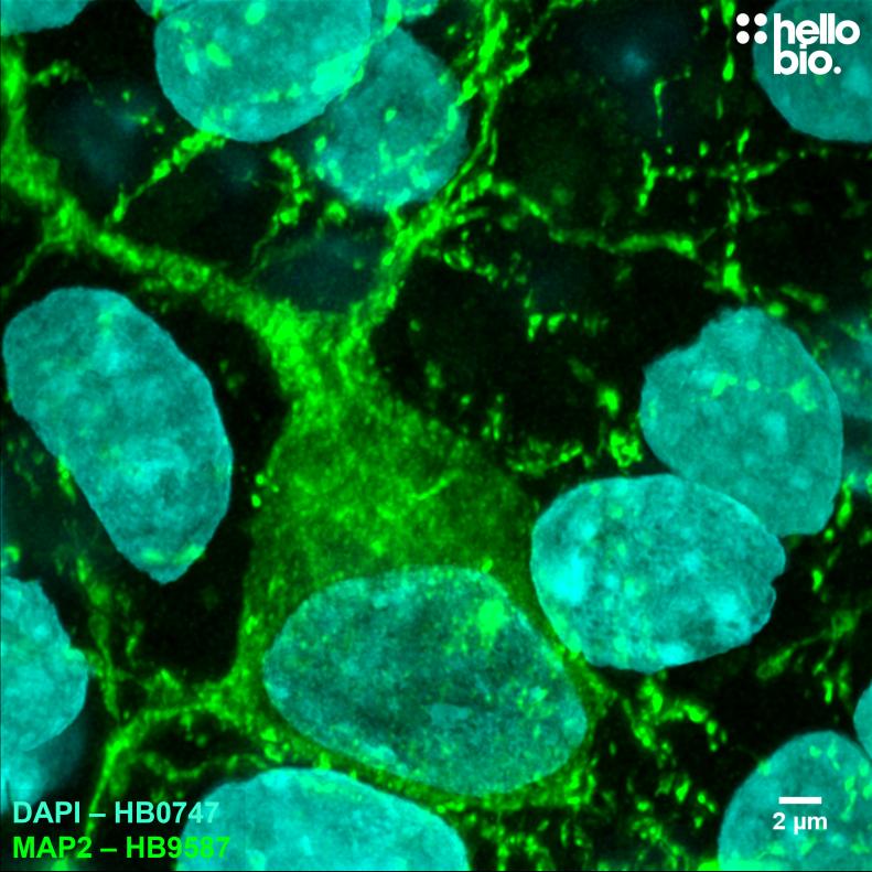 Figure 1. MAP2 expression in cultured rat neurones visualised using HB9587. 