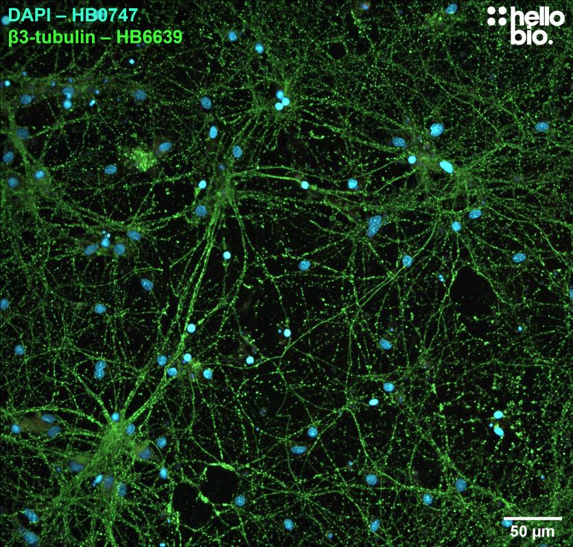 Figure 2. β3-tubulin expression visualised with HB6639 used to label cultured rat neurones