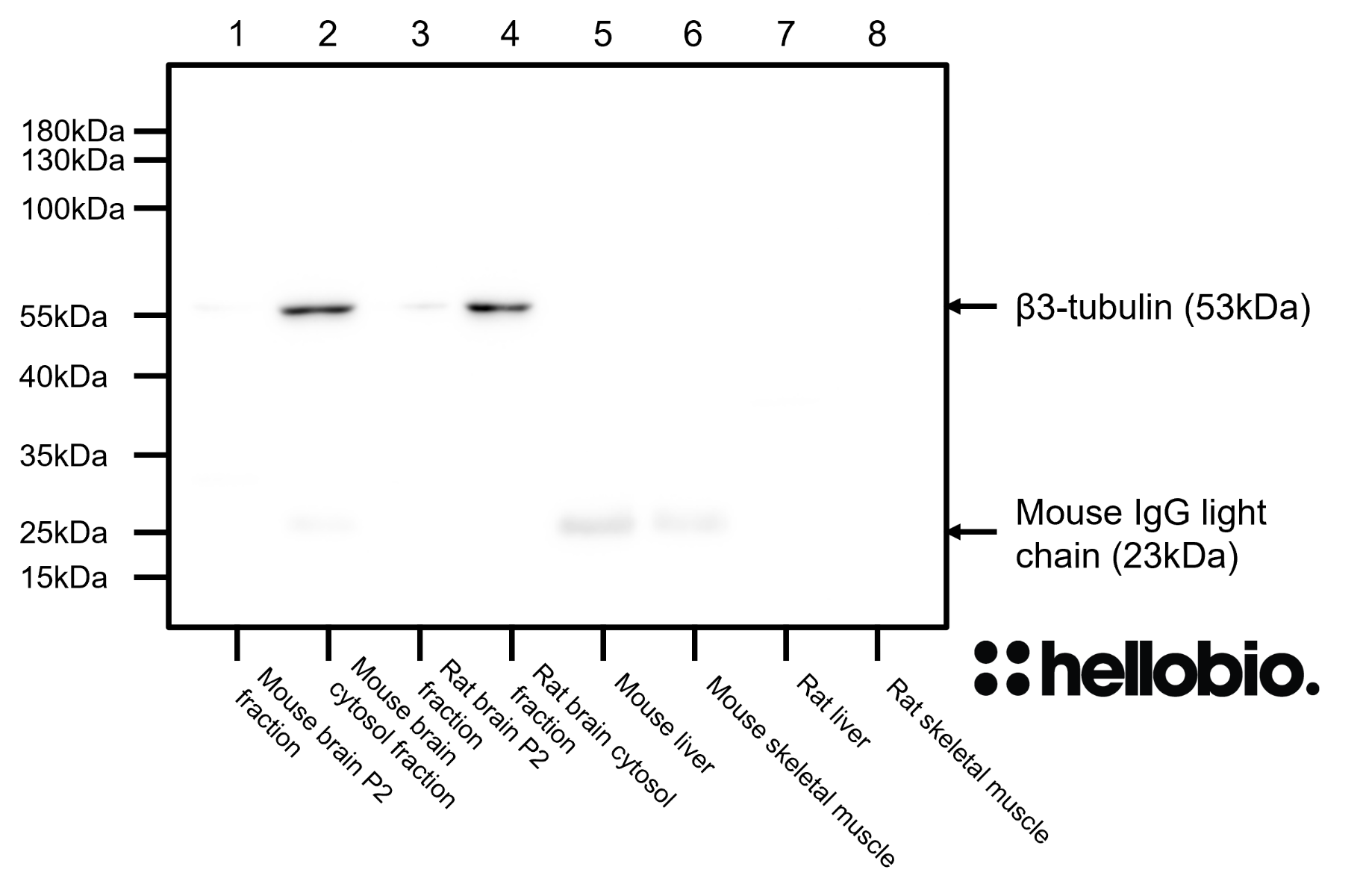 Figure 3. β3-tubulin expression in various tissue lysates and preparations. 