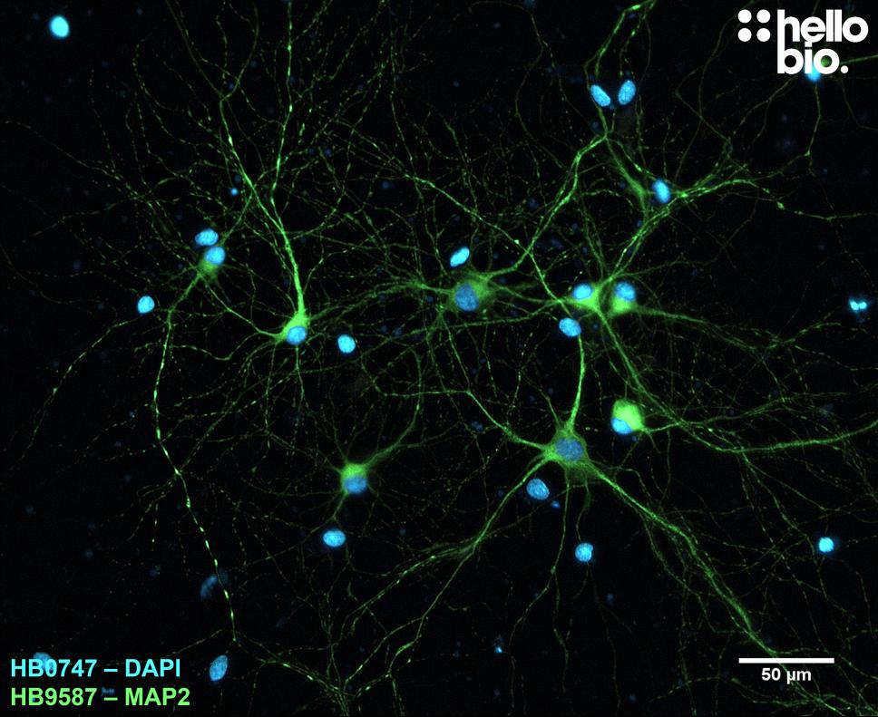 Figure 3. MAP2 expression in cultured rat neurones visualised using HB9587. 