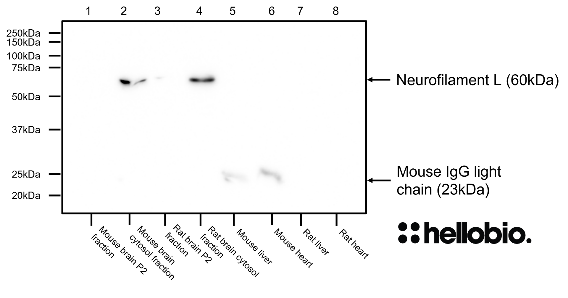 Figure 4. Neurofilament L expression in various tissue lysates and preparations. 