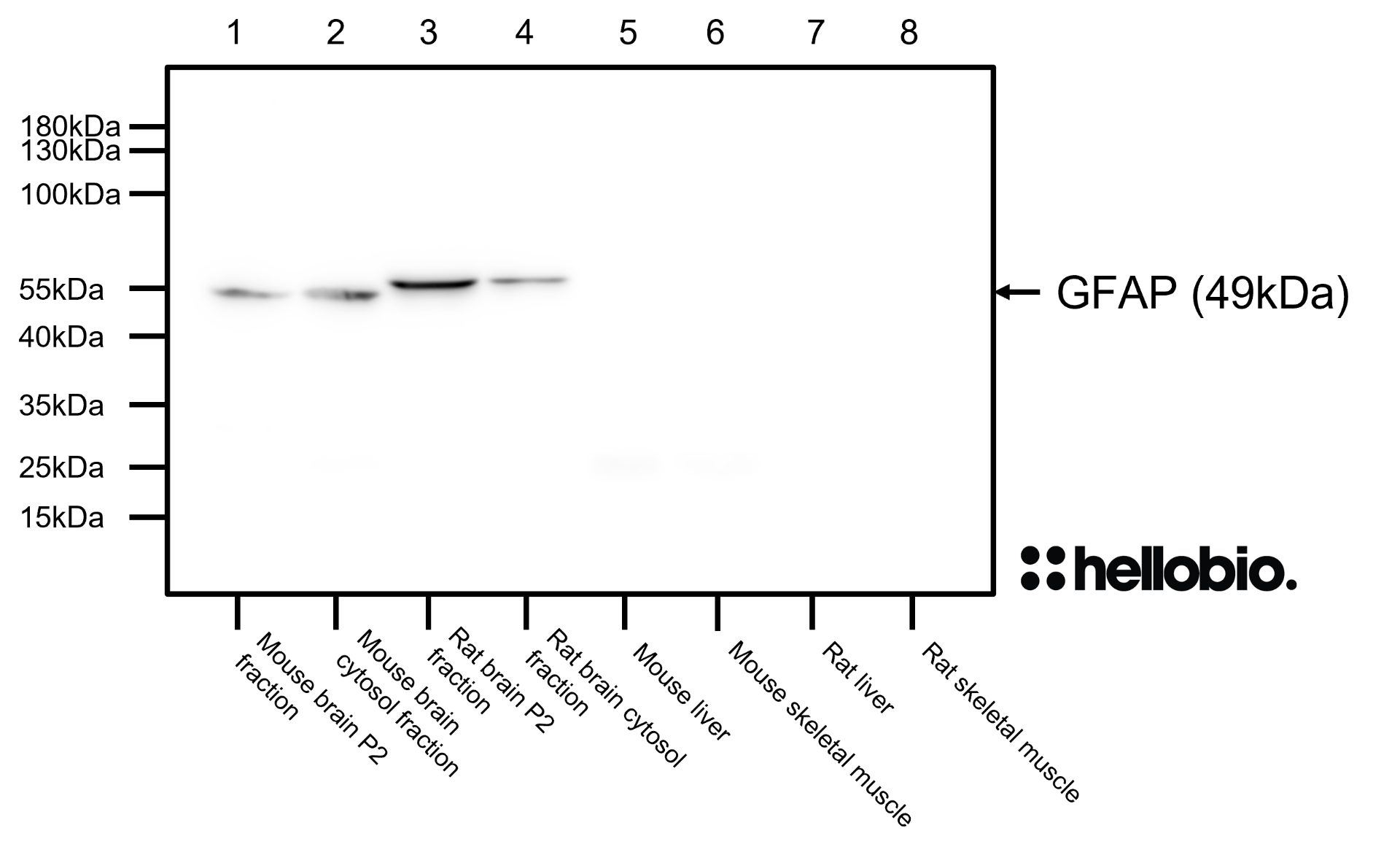 Figure 4. GFAP expression in various tissue lysates and preparations. 