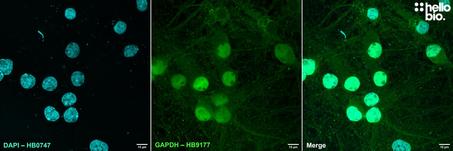 Figure 6. GAPDH expression in cultured rat neurons visualized using HB9177. 